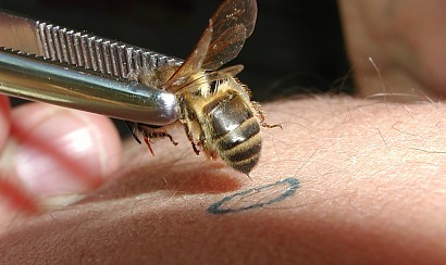 Apithérapie: L'apipuncture par le venin d'abeille L'apipuncture: une branche de l'Apithérapie